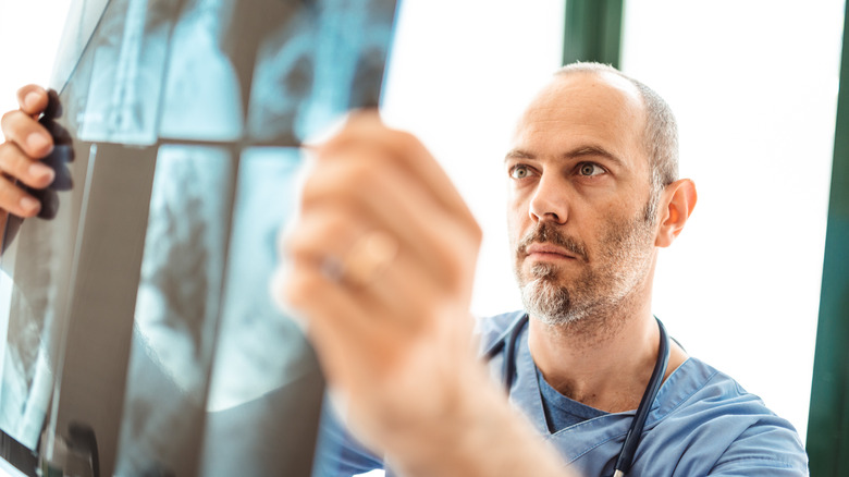 A veterinarian looking at an x-ray.